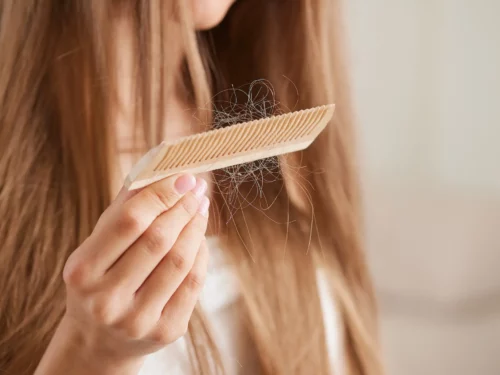 Quand peut-on parler d’une chute de cheveux ?