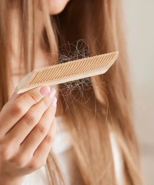 Quand peut-on parler d’une chute de cheveux ?